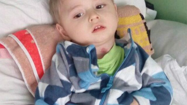 Полуторагодовалый калининградец, на лечение которого собирали средства, начал дышать самостоятельно
