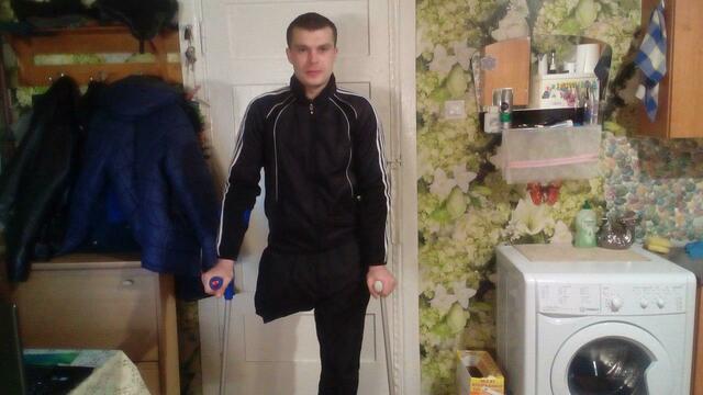 26-летний житель Озёрска, которого ранили грязным мачете, собирает деньги на протез ноги (фото)