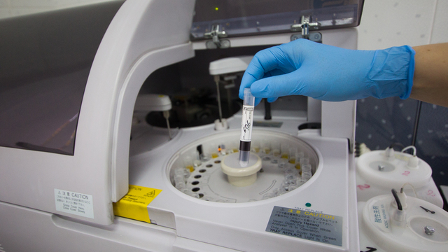 Учёные: употребление сахара способствует развитию слабоумия