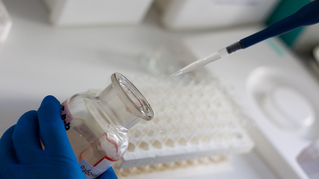 Учёные назвали вред рыбьего жира и подсолнечного масла