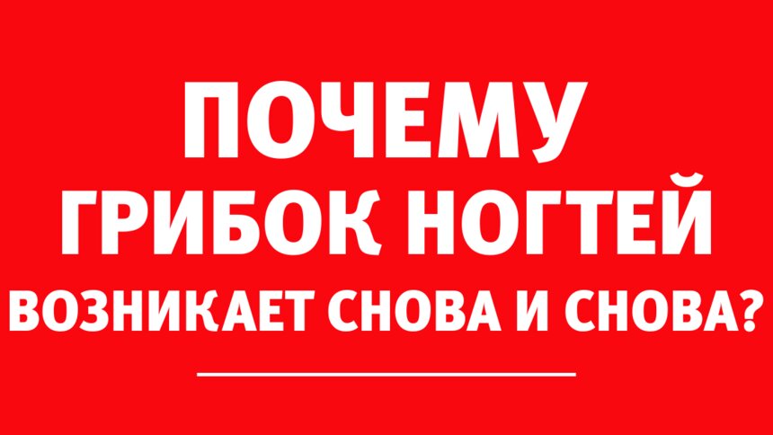 &quot;Лечение грибка ногтей и кожи занимает не менее года&quot;: как в аптеке могут навредить больному - Новости Калининграда