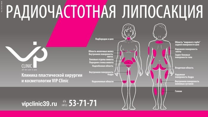 Убрать до 10 литров жировых отложений за одну процедуру с минимальной реабилитацией: что нового предлагают калининградцам пластические хирурги - Новости Калининграда