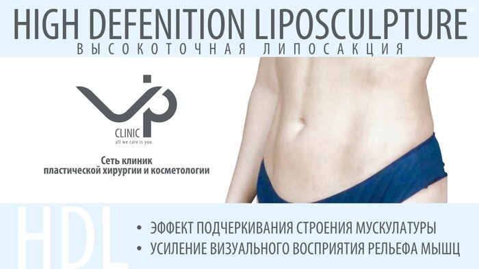 Высокоточная липосакция: в VIP Clinic открыт набор моделей для показательных пластических операций - Новости Калининграда