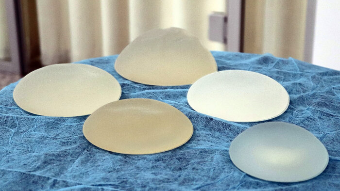 Осложнения после увеличения груди: о чём не скажут пластические хирурги - Новости Калининграда