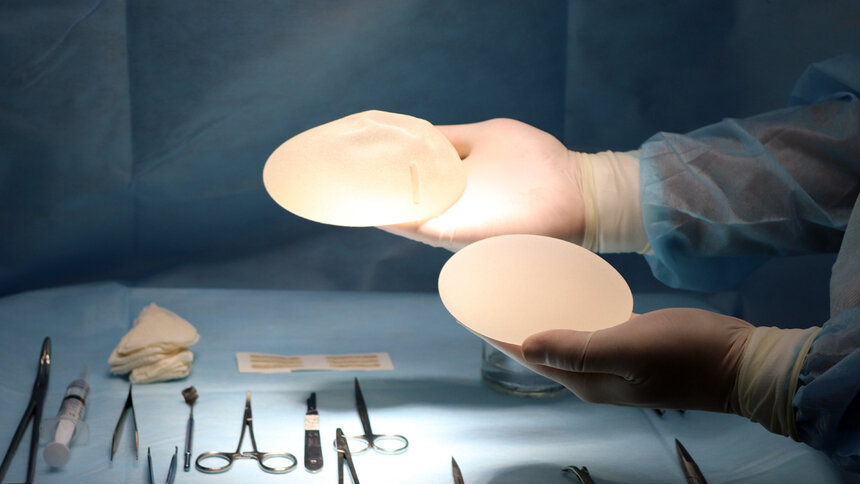 Осложнения после увеличения груди: о чём не скажут пластические хирурги - Новости Калининграда