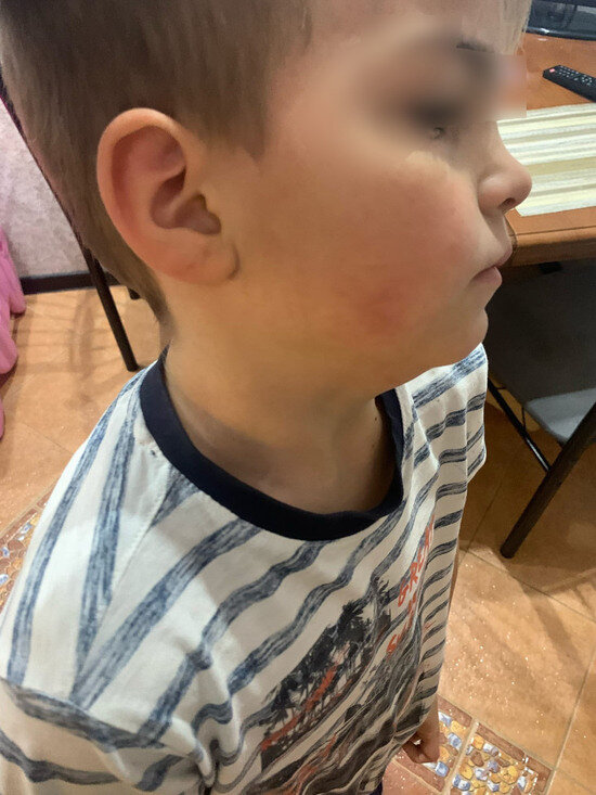 В Калининграде пассажир автобуса ударил 9-летнего школьника за отказ уступить место  - Новости Калининграда | Фото предоставлено героиней публикации