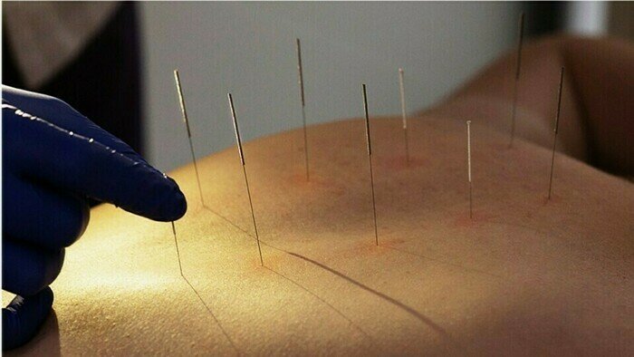 Специалисты медцентра «Инь-Янь» знают, как устранить причину острых состояний с болевым синдромом и последствия коронавируса - Новости Калининграда