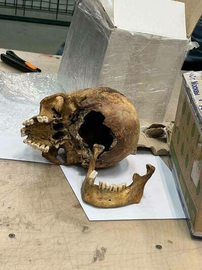 Отправитель указал, что в коробке пластиковая модель: в Москве в посылке обнаружили проломленный человеческий череп - Новости Калининграда | Фото: Telegram-канал ФТС РФ