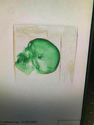 Отправитель указал, что в коробке пластиковая модель: в Москве в посылке обнаружили проломленный человеческий череп - Новости Калининграда | Фото: Telegram-канал ФТС РФ