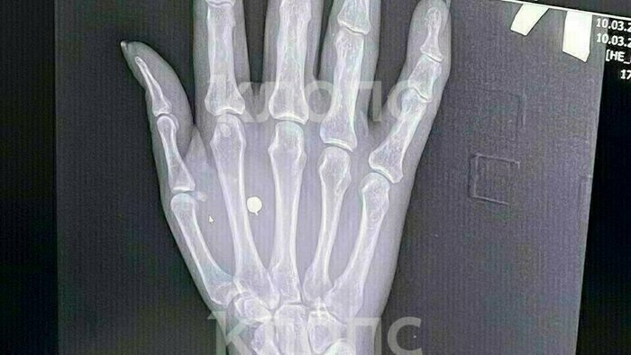 Выборы президента России и новые угрозы Польши: 8 событий, которые обсуждали на неделе   - Новости Калининграда |  Фото: предоставила Галина