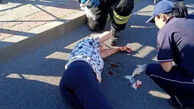 В Светлом 19-летний водитель сбил трёх женщин на пешеходном переходе (фото, видео)  