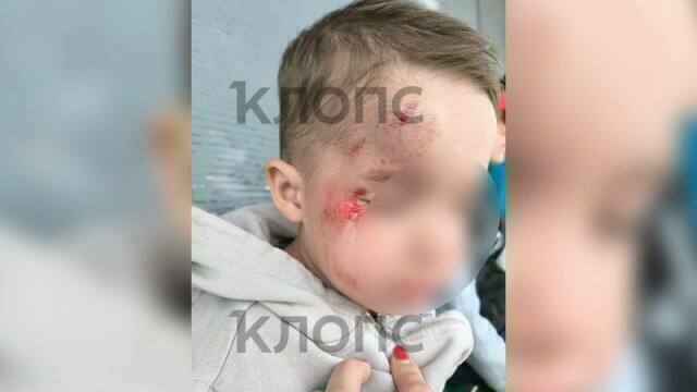 «Сын начал терять сознание»: мама трёхлетнего мальчика — о ДТП с самокатчиком, который снёс ребёнка и уехал
