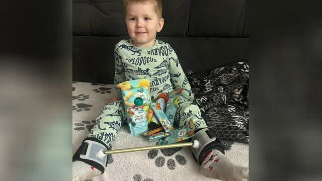 Мальчику из Калининграда, у которого разрушились тазобедренные суставы, попробуют их восстановить (фото)  