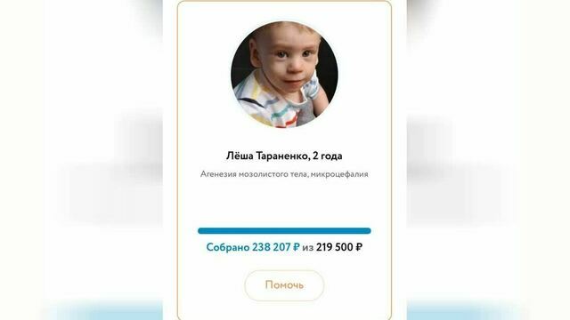 Сбор на помощь калининградскому мальчику с аномалией мозга закрыли за несколько часов