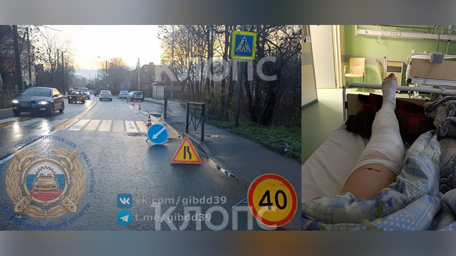 От удара потеряла сознание: в Калининграде на пешеходном переходе сбили маму с 5-летней дочкой (фото)  