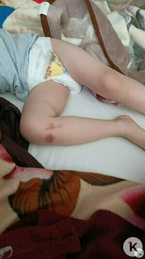 Владелец внезапно сдувшегося батута в Краснознаменске назвал причину происшествия в День защиты детей   - Новости Калининграда | Фото: Екатерина