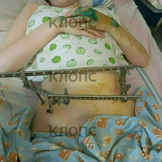 Дочь Елены и её муж ехали на мотоцикле, когда поперёк дороги разворачивалась машина. Мужчина погиб, девочка чудом выжила. | Фото: архив семьи