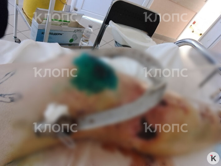 Женщина более полугода передвигалась на инвалидной коляске  | Фото: предоставила Светлана