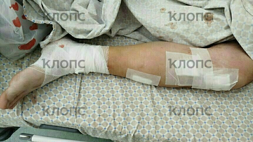 Мужчину избивали не стесняясь свидетелей, под камерами наблюдения  | Фото: предоставила супруга пострадавшего