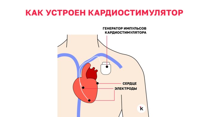 Схема установки прибора | Иллюстрация: Алиса Игонина / Midjourney