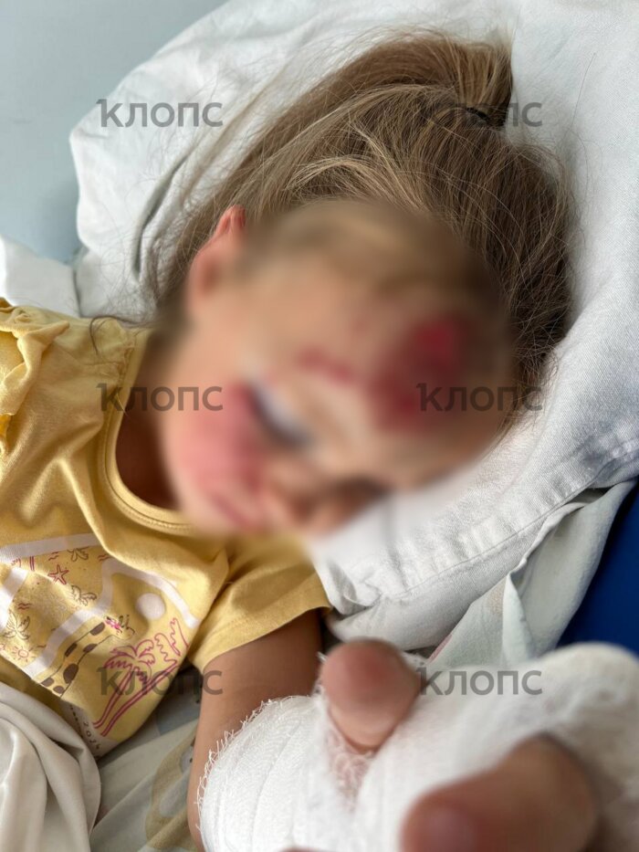 Вике предстоит лечение и наблюдение узких специалистов  | Фото: предоставила Юлия