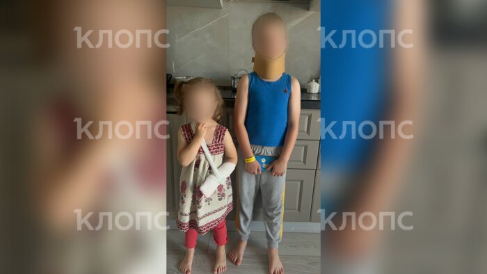 Девочка с переломом руки, у её брата травма шеи | Фото: предоставила Анна 