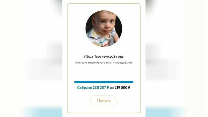 Сбор на помощь калининградскому мальчику с аномалией мозга закрыли за несколько часов - Новости Калининграда Сбор на помощь калининградскому мальчику с аномалией мозга закрыли за несколько часов - Новости Калининграда