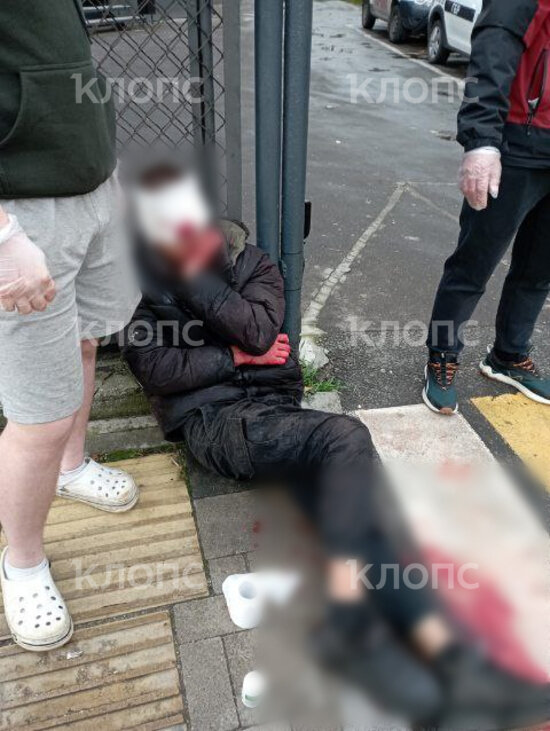 Раненому забинтовали голову и вызвали скорую  | Фото: Алёна Раненому забинтовали голову и вызвали скорую  | Фото: Алёна