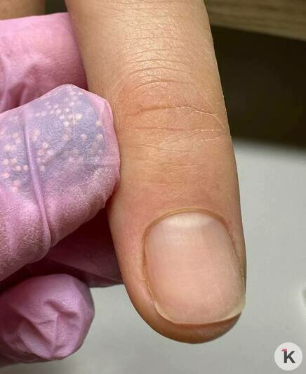 Ногти покрылись плесенью: калининградские мастера маникюра рассказали об ошибках клиентов и безопасных техниках     - Новости Калининграда | Фото: Элла Григорьева