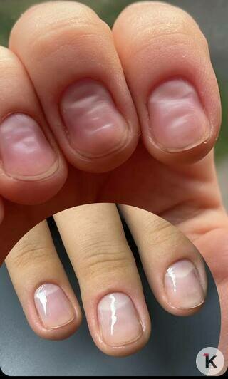 Ногти покрылись плесенью: калининградские мастера маникюра рассказали об ошибках клиентов и безопасных техниках     - Новости Калининграда | Фото: Элла Григорьева