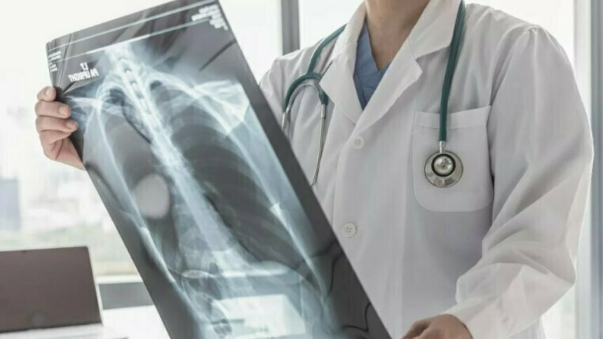 Колоссальный опыт восстановления грыж и протрузий в позвоночнике без операций - Новости Калининграда