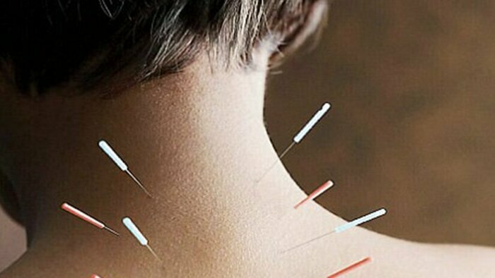 Опытный врач невролог-рефлексотерапевт поможет устранить причину острой и хронической боли - Новости Калининграда