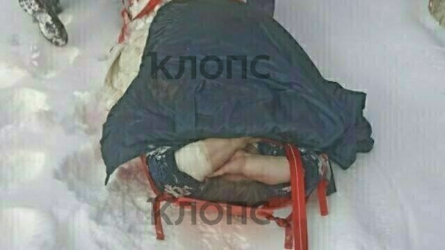 Под Зеленоградском врачам потребовалась помощь спасателей, чтобы вынести женщину весом 200 кг со второго этажа дома к машине скорой (фото)