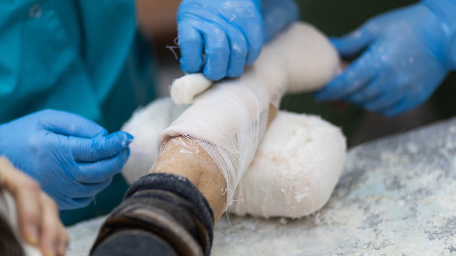 В Калининградской БСМП из-за гололёда госпитализируют по 50 человек в сутки  