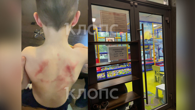 «Мы услышали жуткий крик сына»: в кафе Зеленоградска 5-летний мальчик получил травмы после издевательств подростков  