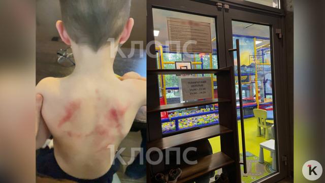 Прокуратура требует взыскать 100 тысяч рублей с кафе, где в детской комнате избили ребёнка    