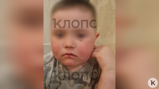 Под Калининградом соседи бросали в ребёнка-инвалида камни и кости, мать два года пытается наказать агрессоров (видео)   