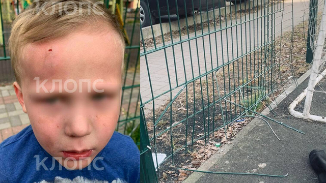 В Калининграде вандалы снова раскурочили забор на детской площадке, где малыш едва не лишился глаза  
