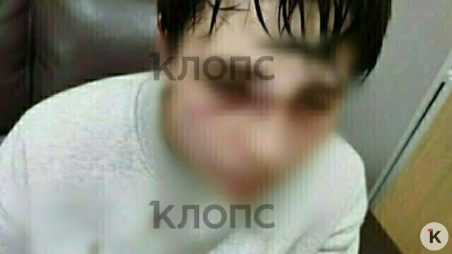 Подросток из посёлка под Калининградом перенёс операцию и оказался в гипсе после драки в школьной раздевалке  