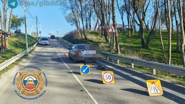 В Гурьевском районе подросток на самокате влетел в легковушку