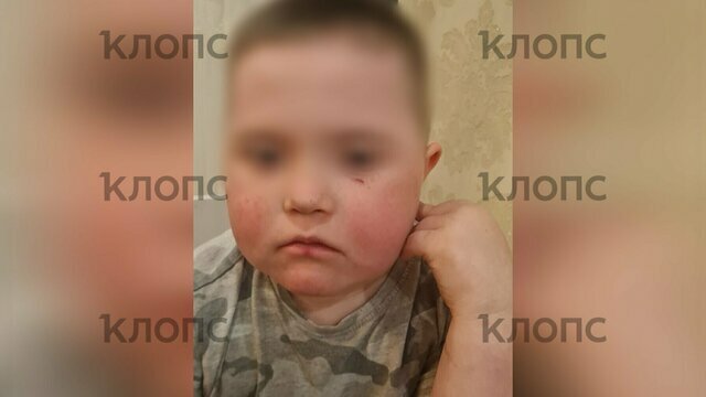В Гурьевском районе суд оштрафовал мужчину, бросавшего камни и кости в ребёнка-инвалида  