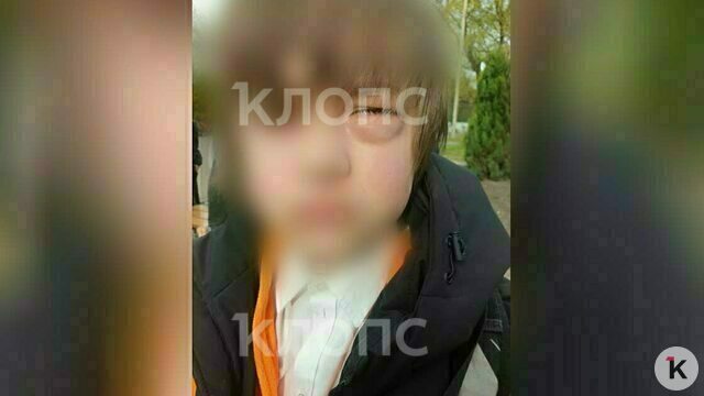 Прокуратура начала проверку после публикации «Клопс» о конфликте в калининградской школе, где ученику сломали глазницу  
