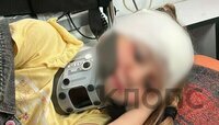 Ушиб головного мозга, перелом руки и лобной кости: в Советске будут судить воспитателя детсада, где покалечилась девочка  