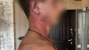 «Мама, это папа. Он был пьяный»: 14-летнего сына калининградки зверски избил и едва не задушил бывший муж  