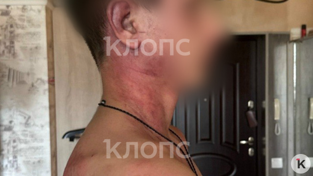 «Мама, это папа. Он был пьяный»: 14-летнего сына калининградки зверски избил и едва не задушил бывший муж  