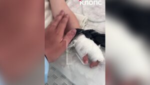 «Булочка моя, всё будет хорошо!»: малышка, сбитая пьяным лихачом в Прибрежном, вышла из комы (видео)  