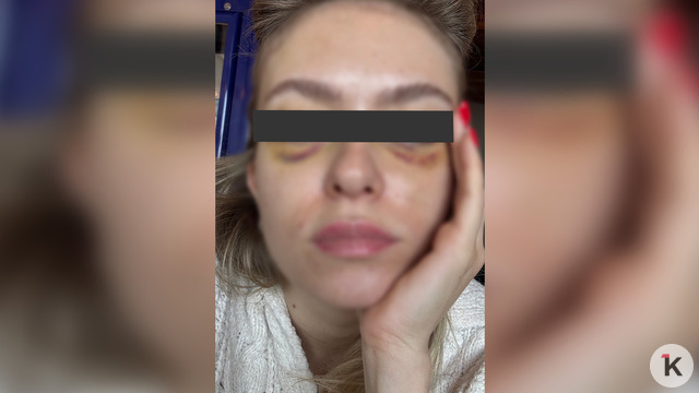 «Пока бьётся моё сердце, я не успокоюсь»: бывший муж превратил жизнь 30-летней калининградки в ад (фото, видео)  