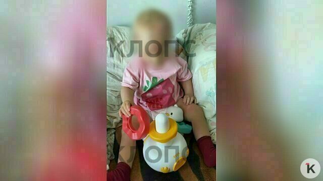 «От лба до затылка не было кожи»: мама сбитой в Прибрежном малышки рассказала о состоянии дочки (видео)  