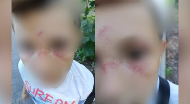 «Он прописал мне лоу-кик»: в Васильково женщина ударила восьмилетнего мальчика после ссоры детей (фото)
