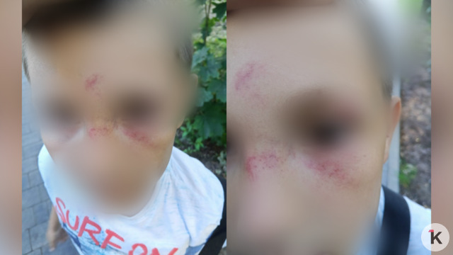 «Пинала ногами и била»: в Васильково женщина ударила восьмилетнего мальчика, который поссорился с её дочкой (фото)